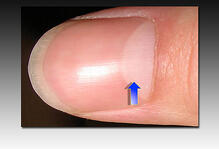 What part of the nail is the arrow pointing to?