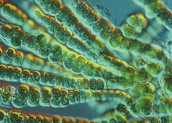 Does blue-green algae cause Alzheimer's? Second Nature Care Environmental Detoxification