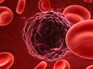 bigstock-Cancer-Cell-2185852 (2)